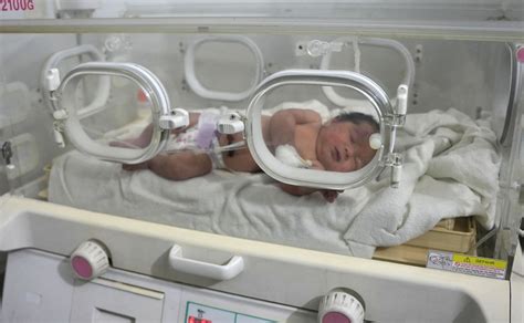 El 'bebé milagro' que miles de personas en todo el mundo quieren adop.